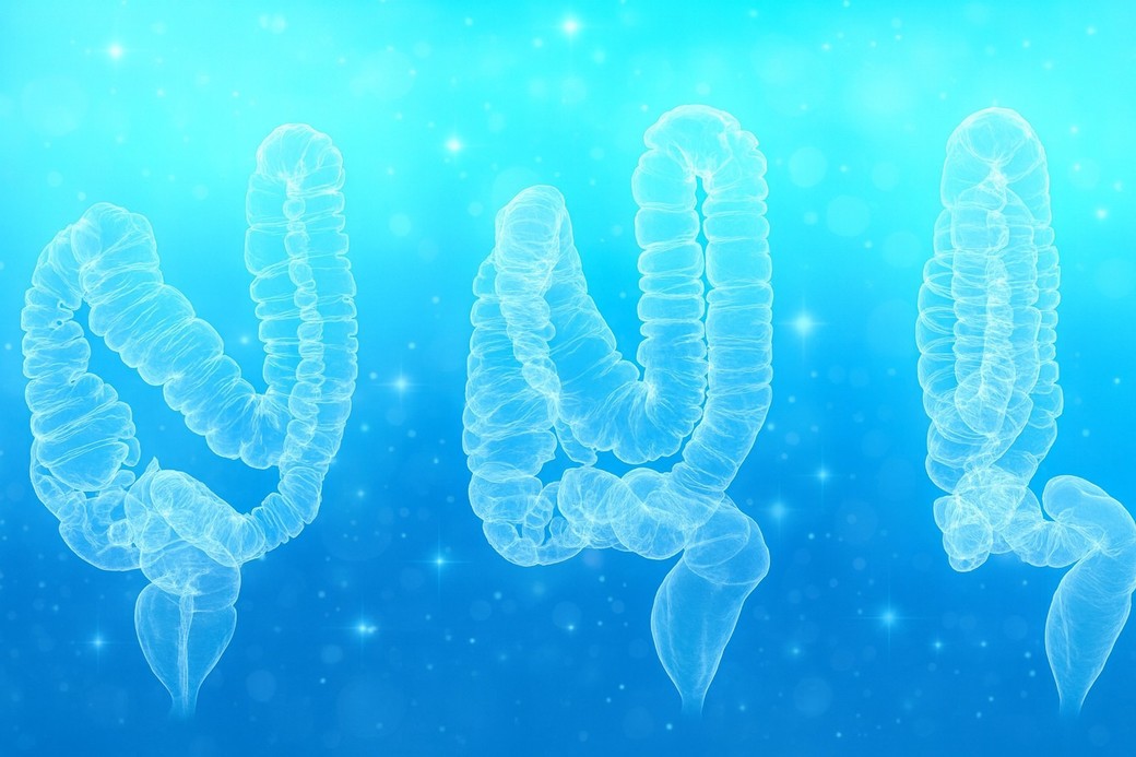 Numărul cazurilor severe de afecţiuni ale colonului, în creştere la tineri