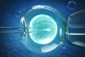 O terapie cu ARNm administrată local la nivelul endometrului, oferă rezultate timpurii promiţătoare în infertilitate