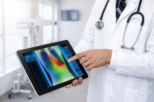 Screeningul pentru cancerul pulmonar ar putea fi accelerat cu ajutorul AI şi al biopsiilor robotizate