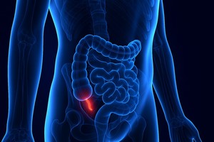 Creştere alarmantă a cancerului de apendice în rândul generaţiei X şi milenialilor americani