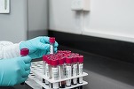 FOTO Un nou test de sânge, cu AI, poate detecta 12 dintre cele mai frecvente tipuri de cancer cu mult înainte de apariția simptomelor