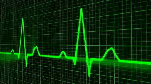 Inteligența artificială va identifica persoanele cu un ritm cardiac anormal