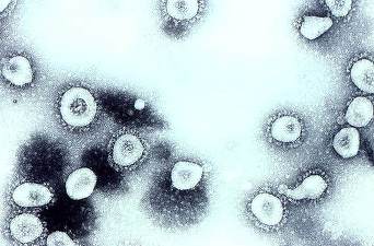 Compania farmaceutică japoneză Takeda dezvoltă un medicament împotriva noului coronavirus