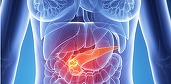Un nou test ar putea depista cancerul pancreatic în stadiile inițiale