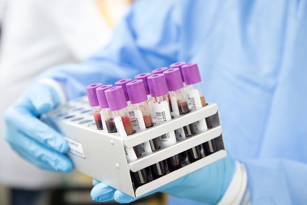 Un nou test de sânge ar putea ajuta la diagnosticarea a peste 50 de tipuri de cancer