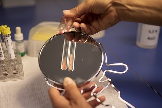 Ministrul Sănătății anunță pentru anul viitor o reformă în domeniul sângelui
