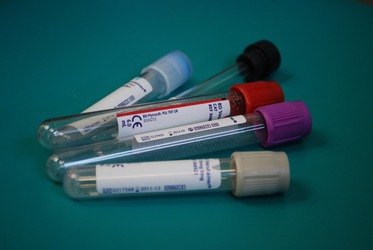 Anunț privind infecția cu hantavirus în România. Specialiștii spun că este una cronică, nu recentă