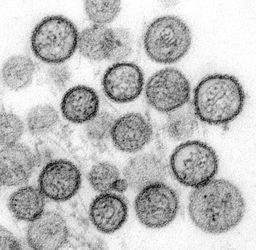 Hantavirus - experții lucrează la ghiduri pentru limitarea primului focar