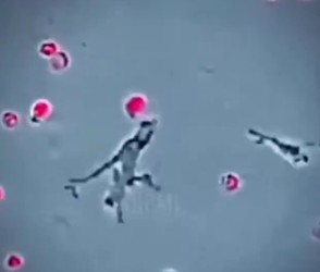 ULTIMA ORĂ OFICIAL Hantavirus în România. Nu e vorba despre tulpina cu transmitere de la om la om