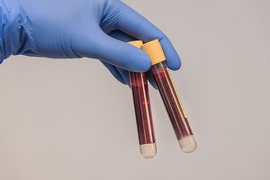 Un virus face ravagii în nordul litoralului. Sute de turiști infectați, toți cu aceleași simptome