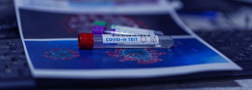Coronavirus: Testele pentru adulții nevaccinați nu vor mai fi gratuite în Franța