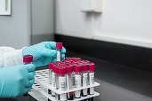 Premieră în istoria medicinei