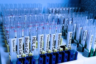 Oportunități 19 octombrie - Spitalul Județean de Urgență Alexandria organizează licitație pentru achiziția de reactivi de laborator