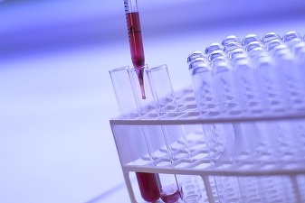 Ministerul Sănătății anunță cinci programe naționale de screening, cu finanțare europeană nerambursabilă în valoare de peste 191 de milioane de euro