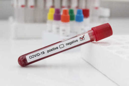 Toate persoanele care tranzitează Turcia trebuie să prezinte un test PCR negativ pentru COVID-19, făcut cu maximum 72 de ore înainte