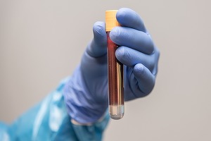 Grecia va renunța la testarea gratuită anti-COVID-19 a persoanelor nevaccinate