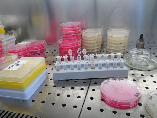 Un nou test de sânge care poate prezice riscul de reapariție a cancerului de sân a fost apreciat ca o descoperire "incredibil de interesantă"
