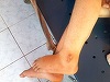 Dosar penal pentru abuz în serviciu la un centru de boli psihice din Vâlcea, după apariţia unor imagini cu oameni legaţi de paturi