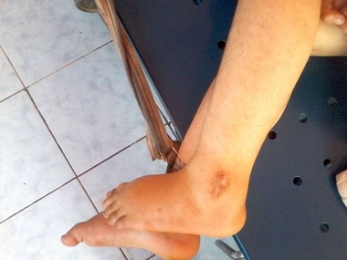 Dosar penal pentru abuz în serviciu la un centru de boli psihice din Vâlcea, după apariţia unor imagini cu oameni legaţi de paturi