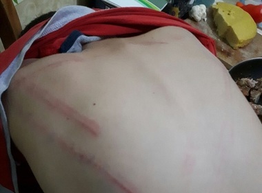 Un bărbat din Arad a fost reţinut de poliţişti după ce şi-a bătut cu o nuia copilul de nouă ani, rănindu-l - FOTO