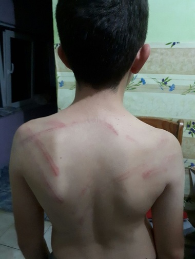 Raport "De ce lovim copiii?": Doar 1 din 10 părinţi nu şi-ar lovi niciodată copilul. 1 din 2 crede că lovirea e pentru binele lui