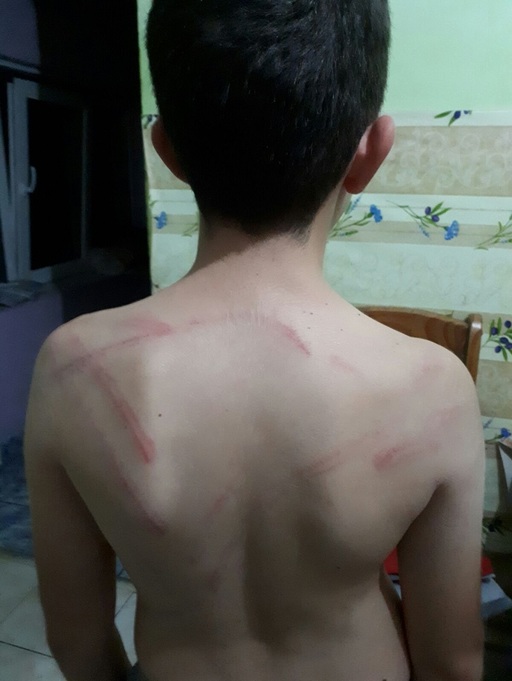 Raport "De ce lovim copiii?": Doar 1 din 10 părinţi nu şi-ar lovi niciodată copilul. 1 din 2 crede că lovirea e pentru binele lui