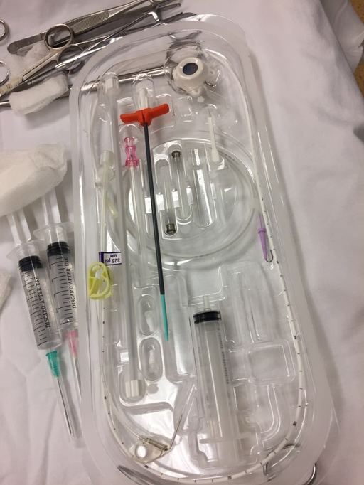 Camere pentru citostatice pot fi implantate gratuit pacienţilor cu afecţiuni oncologice, la Spitalul Judeţean Constanţa