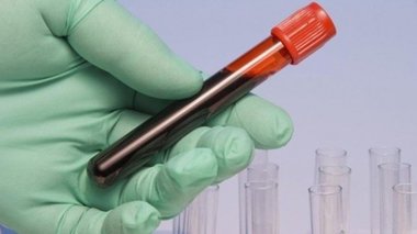Ministrul Sănătăţii: Vineri vor ajunge în ţară 3.850 de doze de imunoglobulină