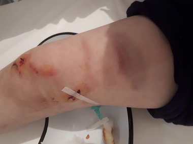 Copil atacat de urs la Călugăreni, în judeţul Harghita - FOTO

