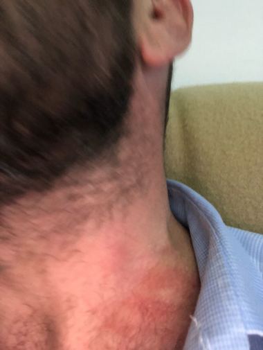 Şeful Comisariatului pentru Protecţia Consumatorilor Constanţa a fost agresat la o terasă din Neptun în timpul unui control; el a fost lovit, strâns de gât şi înjurat. VIDEO