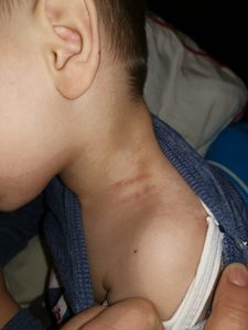 Anchete la o grădiniţă din Focşani după ce părinţii unui băieţel de trei ani au reclamat că o educatoare l-a strâns de gât şi de organele genitale pe copil
