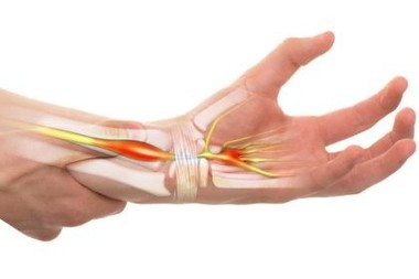 Medic: O boală ascunsă în durerile de mâini afectează din ce în ce mai multe femei, însă se poate opera cu o incizie minimă în palmă