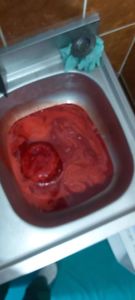 Emanuel Ungureanu: Mii de litri de sânge contaminat şi alte deşeuri infecţioase de la sute de unităţi sanitare din România sunt aruncate zilnic în sistemul de canalizare/ Deputatul publică fotografii de la Spitalul Universitar Bucureşti