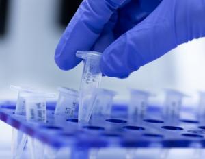 Un număr de 35 de persoane sunt în carantină instituţionalizată şi li se fac teste pentru coronavirus; alte peste 10.000 sunt în izolare la domiciliu