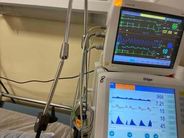 Medic vindecat de coronavirus: Toate spitalele sunt pline, la capacitate maximă/ Despre angajaţii din sistem: Unul câte unul vor cădea; sunt obosiţi, tracasaţi, costumaţi din cap până în picioare şi asta în timp ce unii nu suportă masca

