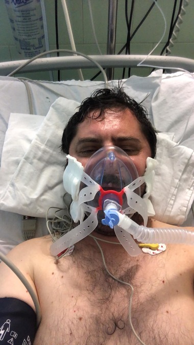 Pacient externat din Secţia ATI Covid a Spitalului Judeţean Sibiu: Nu am fost sedat nici măcar o oră în cele 17 zile / Pacient recalcitrant, care şi-a scos în mod repetat perfuziile şi a lovit cadrele medicale ce încercau să-l ajute, calmat cu empatie