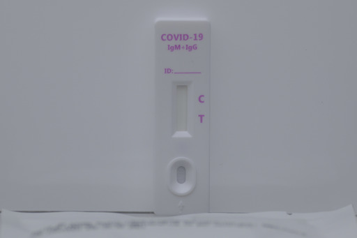 Sorin Cîmpeanu: Au fost utilizate aproape 5.000 de teste din 1.500.000. Infim / Testele antigen rapide au fost considerate de unii părinţi invazive