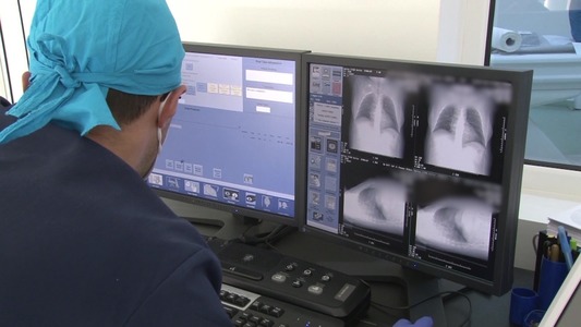 Platformă unică în România pentru obţinerea celei de-a doua opinii în cazul pacienţilor cu boli interstiţiale pulmonare