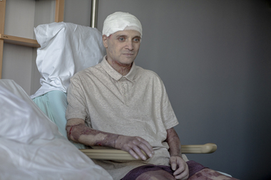 După cazul medicului Cătălin Denciu, Ministerul Sănătăţii şi CNAS anunţă măsuri pentru ca pacienţii cu arsuri grave să beneficieze de concedii medicale pe toată perioada de tratament, inclusiv pentru perioada de recuperare
