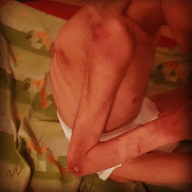Copii şi tineri hrăniţi cu dropsuri şi mâncare stricată, într-un centru pentru persoane cu dizabilităţi severe din Călăraşi / Ei sunt piele şi os şi nu primesc îngrijirea de care au nevoie / Gabriela Firea a dispus un control - FOTO