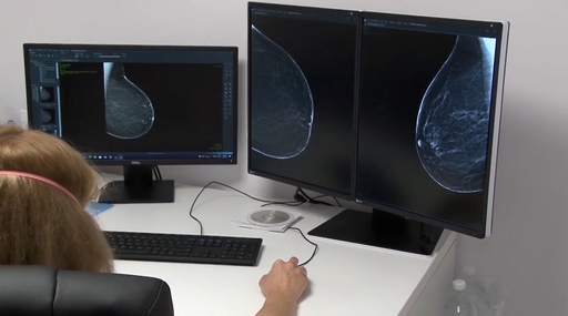 Spitalul de Boli Infecţioase Timişoara se alătură campaniei de realizare gratuită a mamografiilor