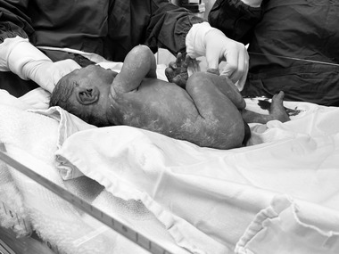 Medic: Am asistat multe naşteri, nu poţi să nu te bucuri / Totuşi, sentimentul este diferit când vezi copii care nasc alţi copii / Este realitatea tristă din România / Suntem în 2022 şi ni se pare ciudat să avem educaţie sexuală în şcoală 