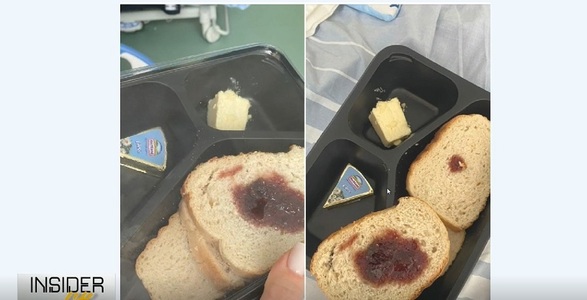Rafila, comentând imagini cu hrana oferită pacienţilor în spitale: Oricâte controale am face noi, nu poţi să schimbi o mentalitate, dacă mentalitatea este de dezinteres pentru această activitate
