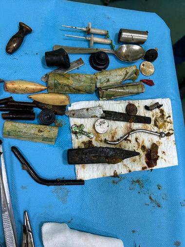 Iaşi: Diverse obiecte, între care bancnote de un leu, un cuţit, dar şi bucăţi de metal, găsite de medici în stomacul unui bărbat / El a ajuns la spital după ce s-a înjunghiat

 