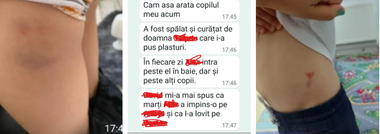 Intervenţie a Poliţiei într-o şcoală din Braşov, după ce presa locală a semnalat că un copil din clasa pregătitoare îşi terorizează colegii. Unii dintre ei au ajuns cu vânătăi acasă
