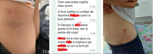Intervenţie a Poliţiei într-o şcoală din Braşov, după ce presa locală a semnalat că un copil din clasa pregătitoare îşi terorizează colegii. Unii dintre ei au ajuns cu vânătăi acasă
