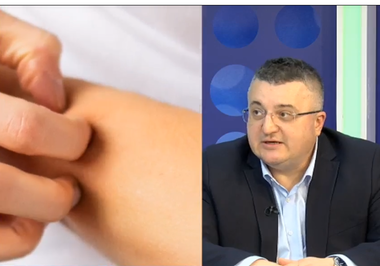 Medic dermatolog: De obicei, momentul vacanţei, al expunerii la soare trezeşte un oarecare soi de conştiinţă, în special referitoare la aluniţe / În ce constă consultul dermatologic complet
