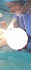 Intervenţie chirurgicală pentru îndepărtarea unei tumori de peste trei kilograme din abdomenul unui copil de nouă ani, la SCJU Arad