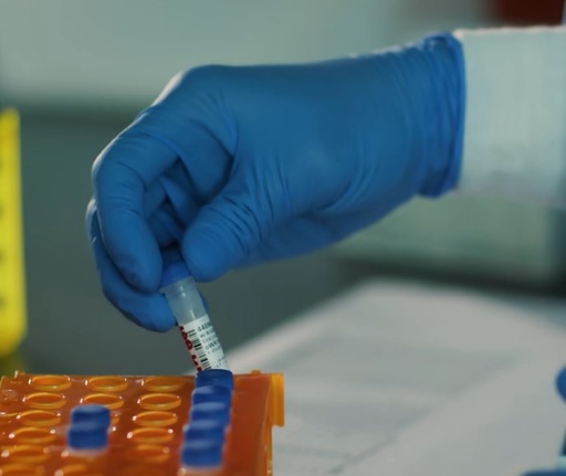 Program de testare gratuită pentru virusul HIV și hepatite, derulat la trei spitale din Capitală. Rezultatele sunt anonime 
