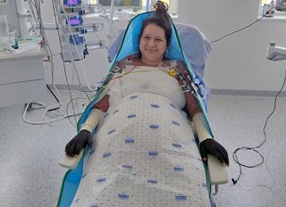 Pacienta internată în Spitalul Floreasca din Capitală, cu arsuri pe 70% din corp, şi transferată apoi în stare gravă la un spital din Belgia a reuşit să stea într-un fotoliu, fiind mutată cu ajutorul unui robot special/ Anunţul surorii sale